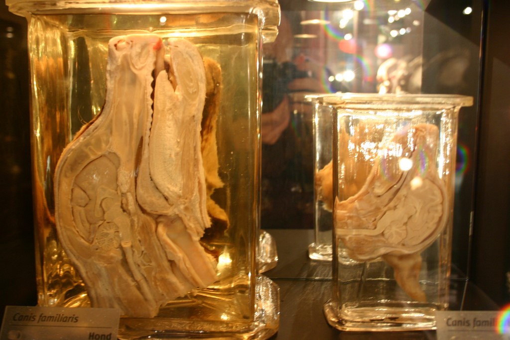 Anatomical collections from the museum Vrolik in Amsterdam